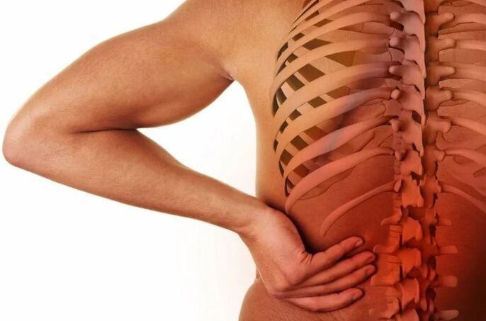 Osteocondrose lumbar