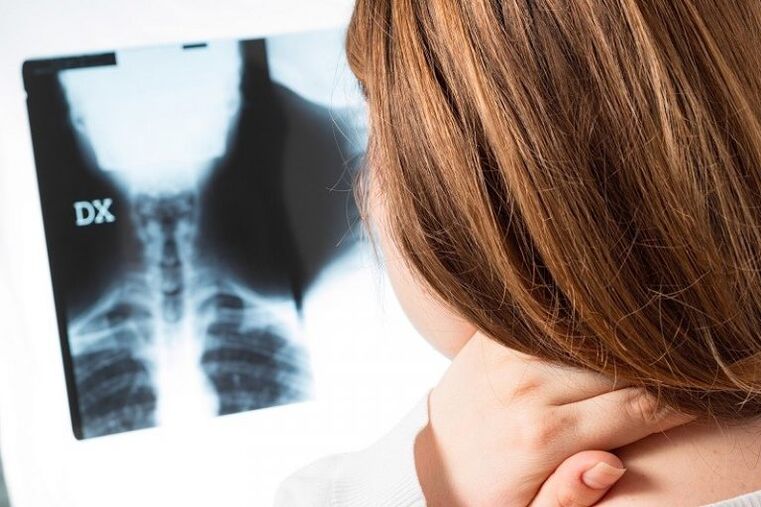 X -ray da rexión cervical