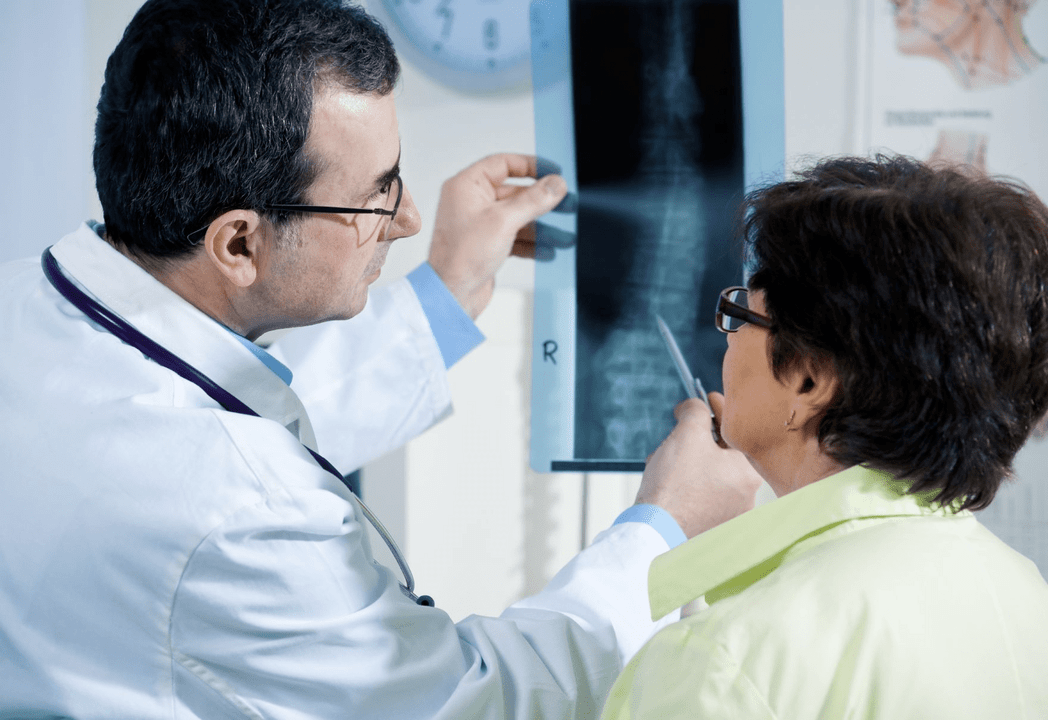 Un neurólogo diagnostica a osteocondrose mediante a radiografía da columna
