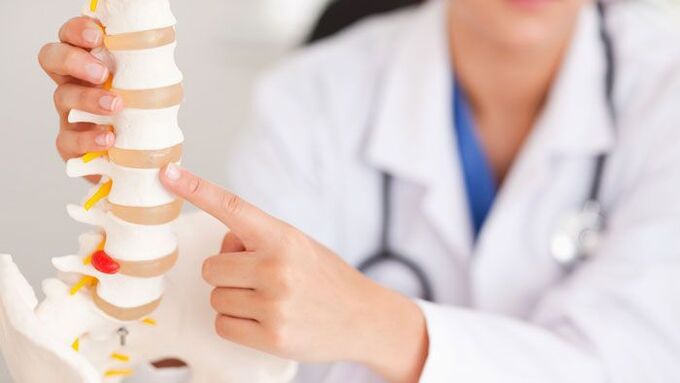explicación da osteocondrose lumbar nun modelo da columna vertebral